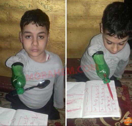 این کودک در اوج فقر نه دست دارد و نه پا